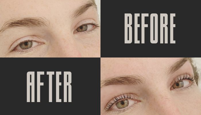 Before and After 1