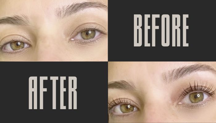 Before and After 2